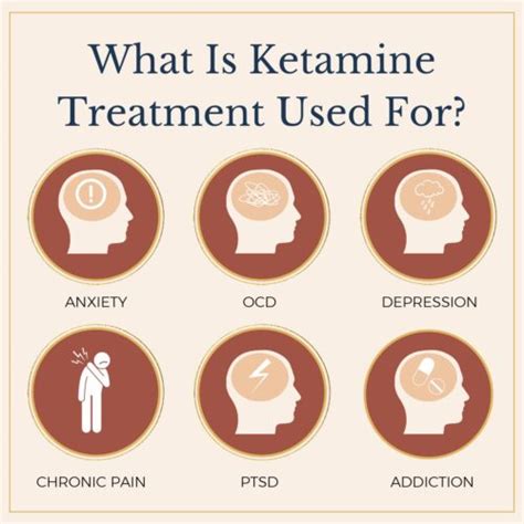 Ketamine Treatments Explained Expectations And Experiences Ketamine Treatments Explained Expectations And Experiences