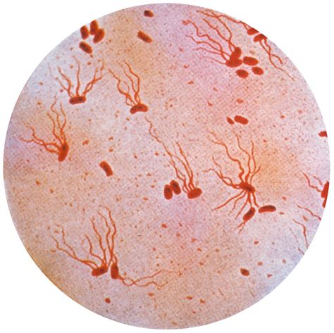 7 Typhoid Prevention Tips