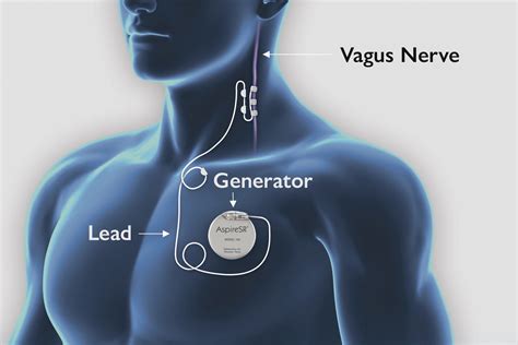 5 Tips VNs